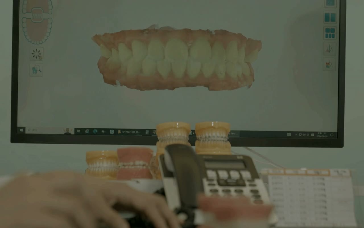치아 이동 계획 화면 · 본원